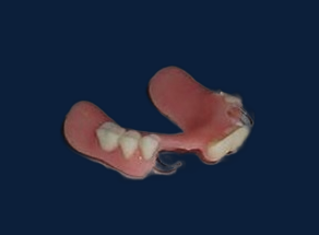 Acrylic Partial Dentures