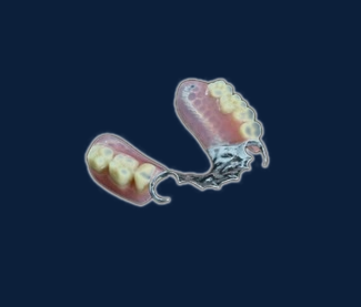 Cast Partial Dentures