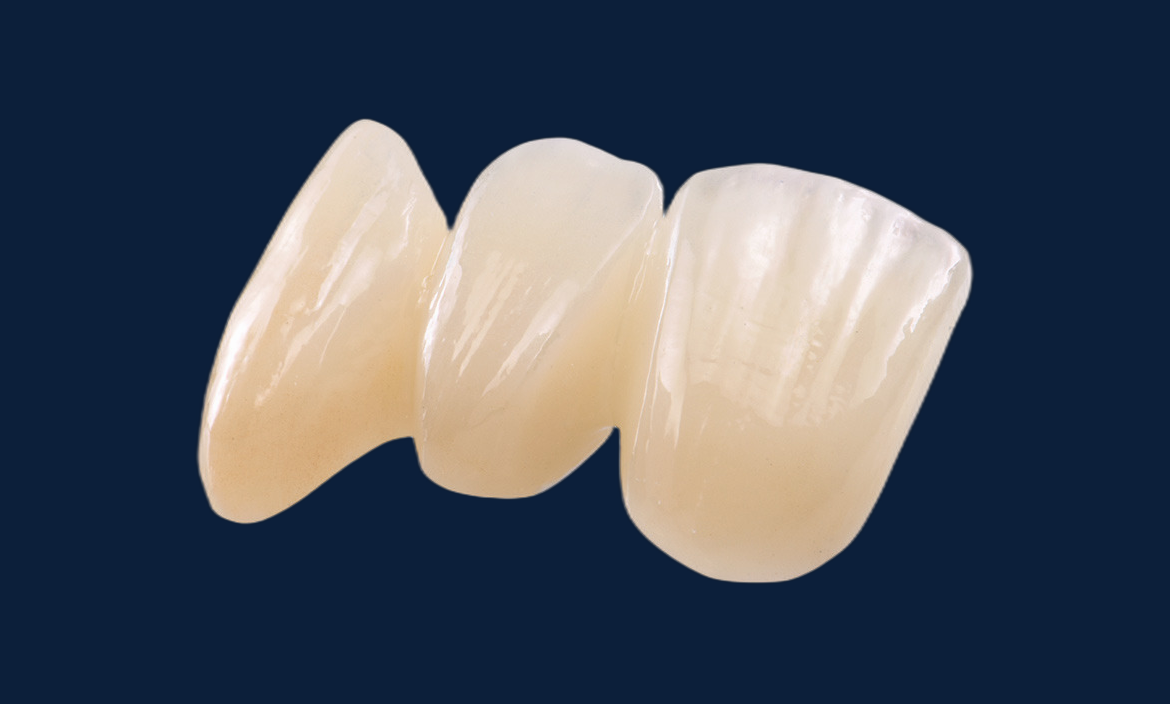 Emax Crown