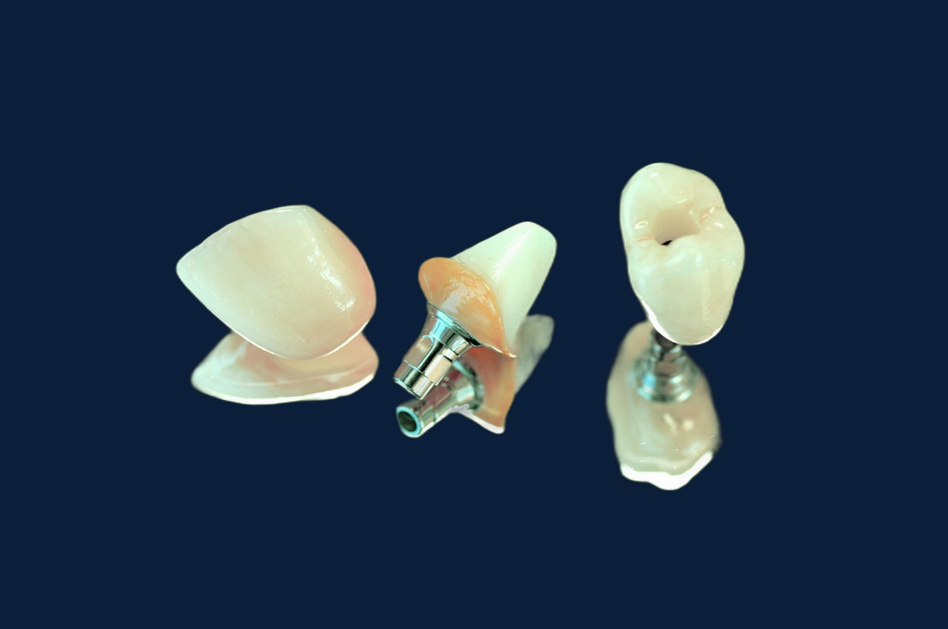 Implant Crown