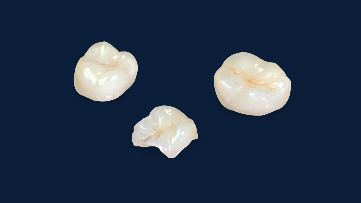 Zirconia Crown